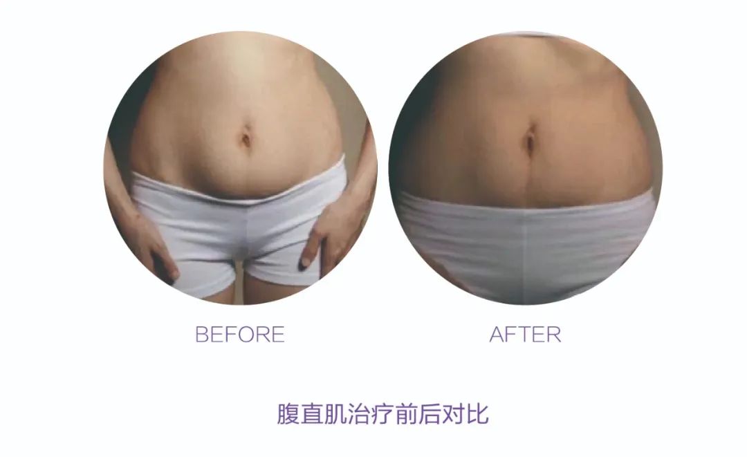 生完孩子就“分开”?!产后妈妈 你得这样“自救”(图7) 生完孩子就“分开”?!产后妈妈 你得这样“自救”(图7)