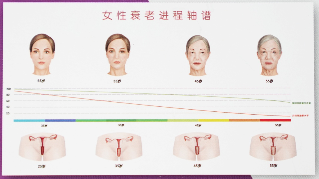 阴道松弛很要“紧”!菲蜜丽私密激光帮你做回小女人!(图5) 阴道松弛很要“紧”!菲蜜丽私密激光帮你做回小女人!(图5)